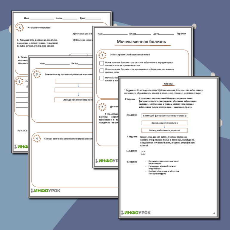 Рабочий лист «Мочекаменная болезнь»